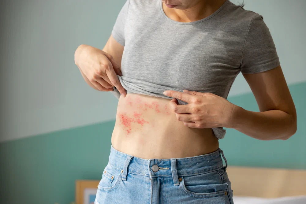 Everything You Need to Know About Shingles – Phipps Pharmacy