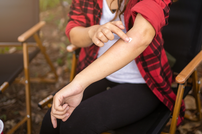 woman applying topical antihistamine to bug bite on arm